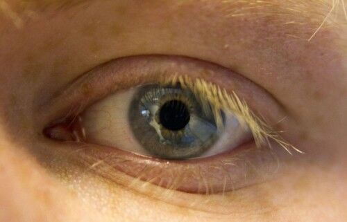 Blinde ser